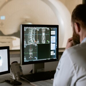 Man looking at CT scan on a computer screen